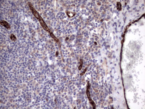 VWF / Von Willebrand Factor Antibody - IHC of paraffin-embedded Human tonsil using anti-VWF mouse monoclonal antibody. (Heat-induced epitope retrieval by 1 mM EDTA in 10mM Tris, pH8.5, 120°C for 3min).