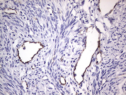 VWF / Von Willebrand Factor Antibody - IHC of paraffin-embedded Human endometrium tissue using anti-VWF mouse monoclonal antibody. (Heat-induced epitope retrieval by 1 mM EDTA in 10mM Tris, pH8.5, 120°C for 3min).