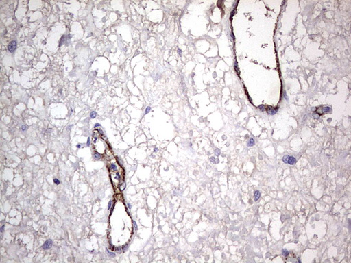 VWF / Von Willebrand Factor Antibody - IHC of paraffin-embedded Human bladder tissue using anti-VWF mouse monoclonal antibody. (Heat-induced epitope retrieval by 1 mM EDTA in 10mM Tris, pH8.5, 120°C for 3min).