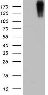 VWF / Von Willebrand Factor Antibody - HEK293T cells were transfected with the pCMV6-ENTRY control (Left lane) or pCMV6-ENTRY VWF (Right lane) cDNA for 48 hrs and lysed. Equivalent amounts of cell lysates (5 ug per lane) were separated by SDS-PAGE and immunoblotted with anti-VWF.