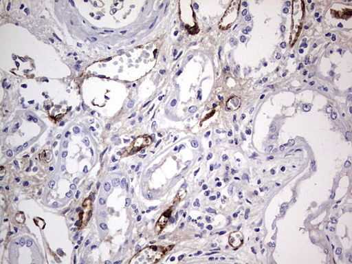 VWF / Von Willebrand Factor Antibody - IHC of paraffin-embedded Human Kidney tissue using anti-VWF mouse monoclonal antibody. (Heat-induced epitope retrieval by 1 mM EDTA in 10mM Tris, pH8.5, 120°C for 3min).