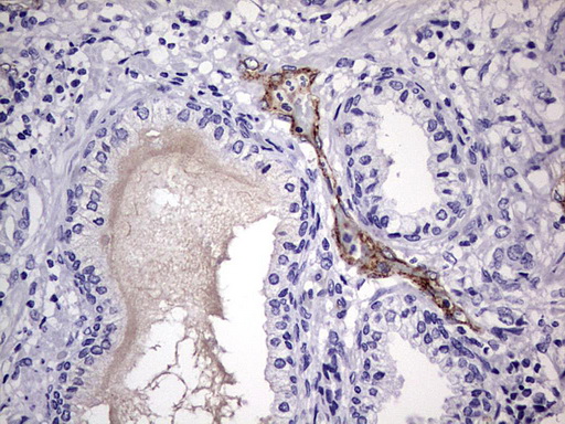 VWF / Von Willebrand Factor Antibody - IHC of paraffin-embedded Human prostate tissue using anti-VWF mouse monoclonal antibody. (Heat-induced epitope retrieval by 1 mM EDTA in 10mM Tris, pH8.5, 120°C for 3min).