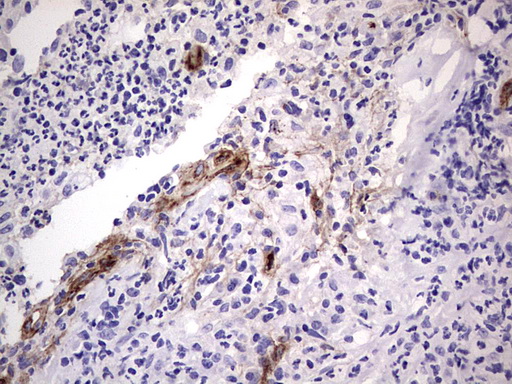 VWF / Von Willebrand Factor Antibody - IHC of paraffin-embedded Human lymph node tissue using anti-VWF mouse monoclonal antibody. (Heat-induced epitope retrieval by 1 mM EDTA in 10mM Tris, pH8.5, 120°C for 3min).