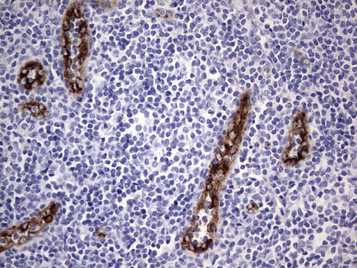 VWF / Von Willebrand Factor Antibody - IHC of paraffin-embedded Human tonsil using anti-VWF mouse monoclonal antibody. (Heat-induced epitope retrieval by 1 mM EDTA in 10mM Tris, pH8.5, 120°C for 3min).