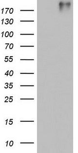 VWF / Von Willebrand Factor Antibody - HEK293T cells were transfected with the pCMV6-ENTRY control (Left lane) or pCMV6-ENTRY VWF (Right lane) cDNA for 48 hrs and lysed. Equivalent amounts of cell lysates (5 ug per lane) were separated by SDS-PAGE and immunoblotted with anti-VWF.