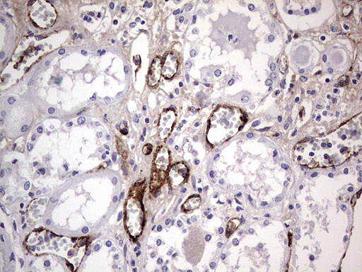 VWF / Von Willebrand Factor Antibody - IHC of paraffin-embedded Human Kidney tissue using anti-VWF mouse monoclonal antibody. (Heat-induced epitope retrieval by 1 mM EDTA in 10mM Tris, pH8.5, 120°C for 3min).