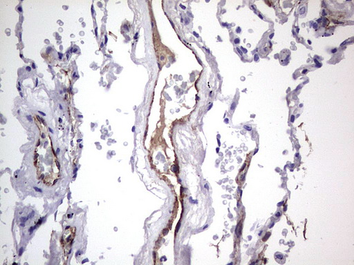 VWF / Von Willebrand Factor Antibody - IHC of paraffin-embedded Human lung tissue using anti-VWF mouse monoclonal antibody. (Heat-induced epitope retrieval by 1 mM EDTA in 10mM Tris, pH8.5, 120°C for 3min).