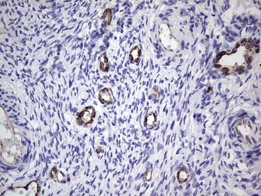 VWF / Von Willebrand Factor Antibody - IHC of paraffin-embedded Human Ovary tissue using anti-VWF mouse monoclonal antibody. (Heat-induced epitope retrieval by 1 mM EDTA in 10mM Tris, pH8.5, 120°C for 3min).
