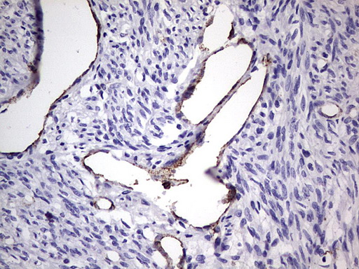 VWF / Von Willebrand Factor Antibody - IHC of paraffin-embedded Human endometrium tissue using anti-VWF mouse monoclonal antibody. (Heat-induced epitope retrieval by 1 mM EDTA in 10mM Tris, pH8.5, 120°C for 3min).