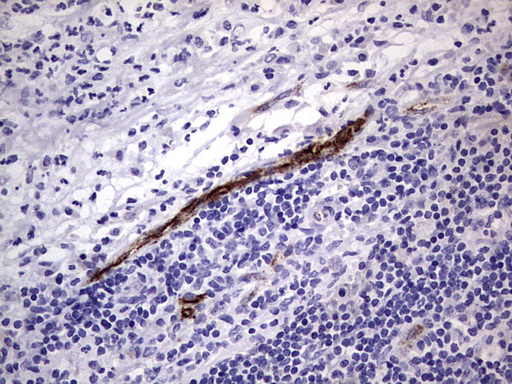 VWF / Von Willebrand Factor Antibody - IHC of paraffin-embedded Human lymph node tissue using anti-VWF mouse monoclonal antibody. (Heat-induced epitope retrieval by 1 mM EDTA in 10mM Tris, pH8.5, 120°C for 3min).