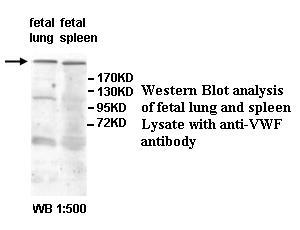 VWF / Von Willebrand Factor Antibody