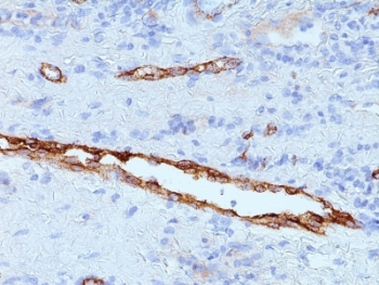 VWF / Von Willebrand Factor Antibody - Formalin-fixed, paraffin-embedded human tonsil stained with anti-vWF antibody (IIIE2.34).  This image was taken for the unmodified form of this product. Other forms have not been tested.