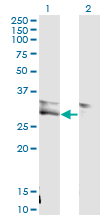VWF / Von Willebrand Factor Antibody - Western Blot analysis of VWF expression in transfected 293T cell line by VWF monoclonal antibody (M02), clone 1A11.Lane 1: VWF transfected lysate(30.2 KDa).Lane 2: Non-transfected lysate.