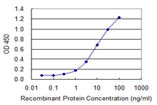 VWF / Von Willebrand Factor Antibody - Detection limit for recombinant GST tagged VWF is 0.1 ng/ml as a capture antibody.
