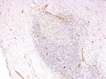 VWF / Von Willebrand Factor Antibody - Formalin-fixed, paraffin-embedded human pancreas stained with vWF antibody (3E2D10 + VWF635).  This image was taken for the unmodified form of this product. Other forms have not been tested.