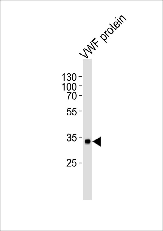 VWF / Von Willebrand Factor Antibody - Western blot of lysate from VWF protein with VWF Antibody. Antibody was diluted at 1:1000. A goat anti-mouse IgG H&L (HRP) at 1:3000 dilution was used as the secondary antibody. Lysate at 35 ug.