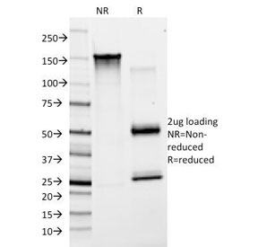 VWF / Von Willebrand Factor Antibody - SDS-PAGE Analysis of Purified, BSA-Free von Willebrand Factor Antibody (clone F8/86). Confirmation of Integrity and Purity of the Antibody.