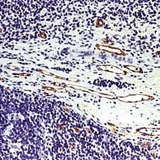 VWF / Von Willebrand Factor Antibody - Formalin-fixed, paraffin-embedded human tonsil stained with Factor VIII Related Antigen antibody.