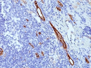 VWF / Von Willebrand Factor Antibody - Formalin-fixed, paraffin-embedded human tonsil stained with anti-von Willebrand Factor antibody (SPM577).  This image was taken for the unmodified form of this product. Other forms have not been tested.