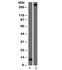 VWF / Von Willebrand Factor Antibody - Western blot testing of 1) partial recombinant protein and 2) human lung lysate with vWF antibody (clone VWF/1465). Predicted molecular weight ~250 kDa.