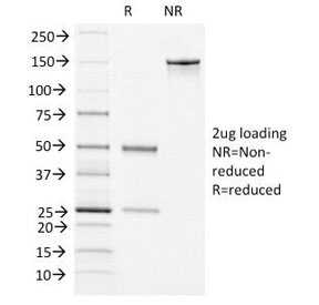 VWF / Von Willebrand Factor Antibody - SDS-PAGE Analysis of Purified, BSA-Free vWF Antibody (clone VWF/1465). Confirmation of Integrity and Purity of the Antibody.