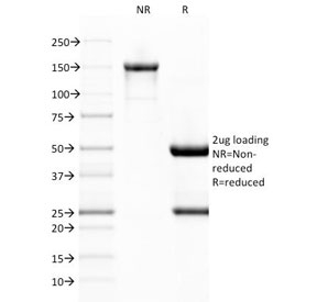 VWF / Von Willebrand Factor Antibody - SDS-PAGE Analysis of Purified, BSA-Free vWF Antibody (clone VWF/1767). Confirmation of Integrity and Purity of the Antibody.