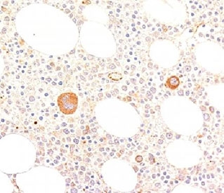 VWF / Von Willebrand Factor Antibody - IHC staining of human bone marrow with von Willebrand Factor antibody (VWF635).