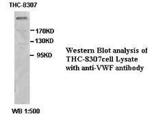 VWF / Von Willebrand Factor Antibody