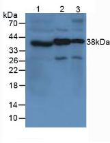 VWF / Von Willebrand Factor Antibody - Western Blot; Sample: Lane1: Human Blood platelet Cells; Lane2: Mouse Brain Tissue; Lane3: Mouse Spinal Cord Tissue.