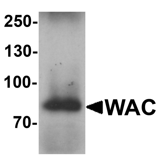 WAC Antibody - Western blot analysis of WAC in human testis tissue lysate with WAC antibody at 1 ug/ml.