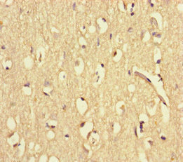 WAC Antibody - Immunohistochemistry of paraffin-embedded human brain tissue at dilution of 1:100
