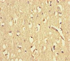WAC Antibody - Immunohistochemistry of paraffin-embedded human brain tissue at dilution of 1:100