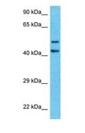 WAC Antibody - Western blot of WAC Antibody with human HeLa Whole Cell lysate.  This image was taken for the unconjugated form of this product. Other forms have not been tested.
