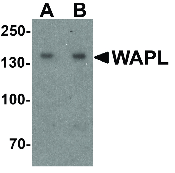 WAPAL / WAPL Antibody - Western blot analysis of WAPL in A20 cell lysate with WAPL antibody at (A) 1 and (B) 2 ug/ml.