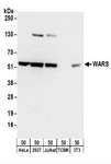 WARS Antibody - Detection of Human and Mouse WARS by Western Blot. Samples: Whole cell lysate (50 ug) from HeLa, 293T, Jurkat, mouse TCMK-1, and mouse NIH3T3 cells. Antibodies: Affinity purified rabbit anti-WARS antibody used for WB at 0.1 ug/ml. Detection: Chemiluminescence with an exposure time of 30 seconds.