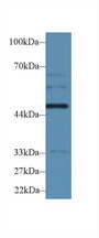 WARS Antibody - Western Blot; Sample: Human HepG2 cell lysate; Primary Ab: 2µg/ml Rabbit Anti-Rat WARS Antibody Second Ab: 0.2µg/mL HRP-Linked Caprine Anti-Rabbit IgG Polyclonal Antibody