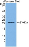 WARS Antibody - Western blot of recombinant WARS.