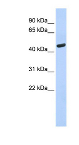 WARS Antibody - WARS antibody Western blot of Fetal Brain lysate. This image was taken for the unconjugated form of this product. Other forms have not been tested.