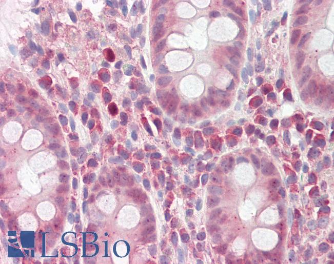 WARS Antibody - Anti-WARS antibody IHC of human colon. Immunohistochemistry of formalin-fixed, paraffin-embedded tissue after heat-induced antigen retrieval. Antibody dilution 2.5-5 ug/ml. This image was taken for the unconjugated form of this product. Other forms have not been tested.