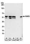 WARS Antibody - Detection of Human and Mouse WARS by Western Blot. Samples: Whole cell lysate (50 ug) from HeLa, 293T, Jurkat, mouse TCMK-1, and mouse NIH3T3 cells. Antibodies: Affinity purified rabbit anti-WARS antibody used for WB at 0.1 ug/ml. Detection: Chemiluminescence with an exposure time of 3 minutes.
