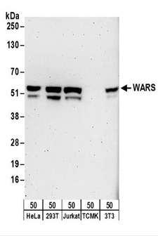 WARS Antibody - Detection of Human and Mouse WARS by Western Blot. Samples: Whole cell lysate (50 ug) from HeLa, 293T, Jurkat, mouse TCMK-1, and mouse NIH3T3 cells. Antibodies: Affinity purified rabbit anti-WARS antibody used for WB at 0.1 ug/ml. Detection: Chemiluminescence with an exposure time of 3 minutes.