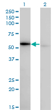 WARS Antibody - Western Blot analysis of WARS expression in transfected 293T cell line by WARS monoclonal antibody (M02), clone 3A12.Lane 1: WARS transfected lysate(53.2 KDa).Lane 2: Non-transfected lysate.
