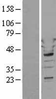 WARS Protein - Western validation with an anti-DDK antibody * L: Control HEK293 lysate R: Over-expression lysate