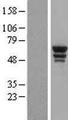 WARS Protein - Western validation with an anti-DDK antibody * L: Control HEK293 lysate R: Over-expression lysate