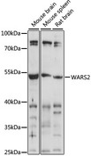 WARS2 Antibody - Western blot analysis of extracts of various cell lines, using WARS2 antibody at 1:1000 dilution. The secondary antibody used was an HRP Goat Anti-Rabbit IgG (H+L) at 1:10000 dilution. Lysates were loaded 25ug per lane and 3% nonfat dry milk in TBST was used for blocking. An ECL Kit was used for detection and the exposure time was 30s.