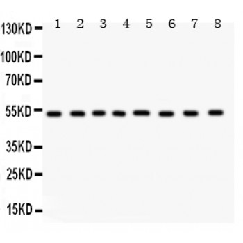 WAS / WASP Antibody - WASP antibody Western blot. All lanes: Anti WASP at 0.5 ug/ml. Lane 1: Rat Liver Tissue Lysate at 50 ug. Lane 2: Human Placenta Tissue Lysate at 50 ug. Lane 3: Rat Spleen Tissue Lysate at 50 ug. Lane 4: Rat Pancreas Tissue Lysate at 50 ug. Lane 5: HEPG2 Whole Cell Lysate at 40 ug. Lane 6: HELA Whole Cell Lysate at 40 ug. Lane 7: HEPA Whole Cell Lysate at 40 ug. Lane 8: 22RV1 Whole Cell Lysate at 40 ug. Predicted band size: 53 kD. Observed band size: 53 kD.