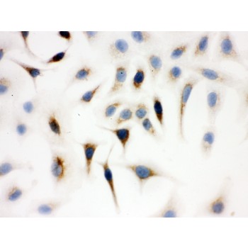 WAS / WASP Antibody - WASP antibody ICC. ICC: A549 Cell.