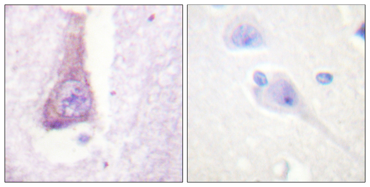 WAS / WASP Antibody - Immunohistochemistry analysis of paraffin-embedded human brain tissue, using WASP Antibody. The picture on the right is blocked with the synthesized peptide.