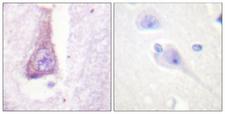 WAS / WASP Antibody - Immunohistochemistry analysis of paraffin-embedded human brain tissue, using WASP Antibody. The picture on the right is blocked with the synthesized peptide.
