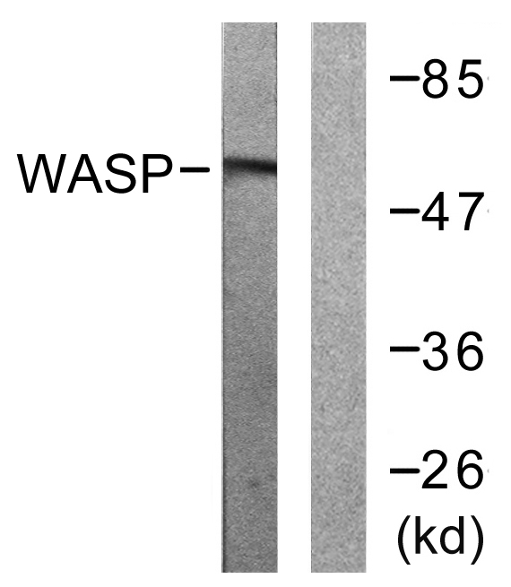 WAS / WASP Antibody - Western blot analysis of lysates from HepG2 cells, using WASP Antibody. The lane on the right is blocked with the synthesized peptide.